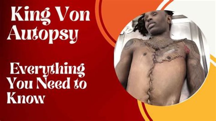 King Von Autopsy: Unraveling The Truth Behind The Legend