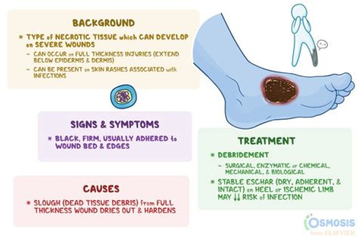 Understanding Scar Tissue In A 14-Year-Old: Causes, Implications, And Treatments