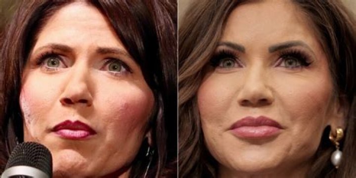 Unveiling The Truth: Newskristi Noem Plastic Surgery Before After Pictures